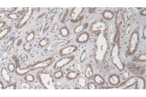 Detection of COL1a2 in Human Kidney Tissue using Polyclonal Antibody to Collagen Type I Alpha 2 (COL1a2) (COL1A2 Antikörper  (AA 1103-1366))