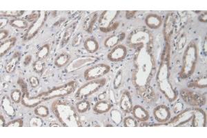 Detection of COL1a2 in Human Kidney Tissue using Polyclonal Antibody to Collagen Type I Alpha 2 (COL1a2)