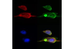 ABIN6260502 and ABIN6268715 staining Hela by IF/ICC.