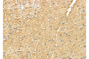 ABIN6261686 and ABIN6278857 at 1/100 staining Rat heart tissue by IHC-P. (FAT1 Antikörper  (C-Term))