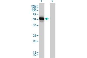Western Blot analysis of GPT expression in transfected 293T cell line by GPT monoclonal antibody (M03), clone 4E2. (ALT Antikörper  (AA 1-496))