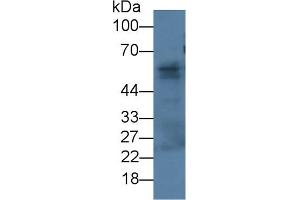 Detection of FBLN3 in Rat Skin lysate using Monoclonal Antibody to Fibulin 3 (FBLN3) (FBLN3 Antikörper  (AA 26-213))