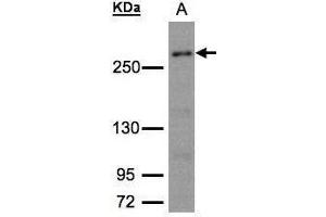 WB Image Sample (30μg whole cell lysate) A:293T whole cell lysate 5% SDS PAGE antibody diluted at 1:1500 (CAD Antikörper  (C-Term))