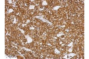 IHC-P Image Immunohistochemical analysis of paraffin-embedded RF48 xenograft, using L-Plastin, antibody at 1:500 dilution.