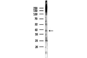 anti-Uroporphyrinogen Decarboxylase (UROD) (C-Term) antibody