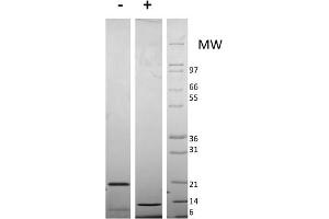 SDS-PAGE of Mouse Resistin Dimer Recombinant Protein SDS-PAGE of Mouse Resistin Dimer Recombinant Protein. (Resistin Dimer Protein)