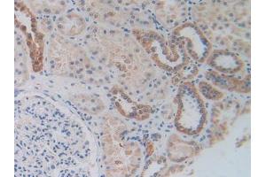 Figure. (MAPKAP Kinase 2 Antikörper  (AA 139-367))