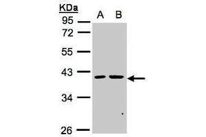 WB Image Sample(30 ug whole cell lysate) A:MOLT4 , B:Raji , 10% SDS PAGE antibody diluted at 1:1000