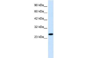 WB Suggested Anti-RGS13 Antibody Titration:  1. (RGS13 Antikörper  (Middle Region))
