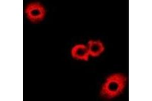 Immunofluorescent analysis of Fumarylacetoacetase staining in A549 cells.