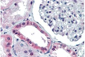 Human Kidney (formalin-fixed, paraffin-embedded) stained with PAX4 antibody ABIN462174 followed by biotinylated goat anti-rabbit IgG secondary antibody ABIN481713, alkaline phosphatase-streptavidin and chromogen. (PAX4 Antikörper  (AA 166-215))