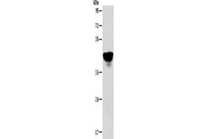 Gel: 10 % SDS-PAGE, Lysate: 40 μg, Lane: A431 cells, Primary antibody: ABIN7128138(ABHD5 Antibody) at dilution 1/250, Secondary antibody: Goat anti rabbit IgG at 1/8000 dilution, Exposure time: 5 seconds (ABHD5 Antikörper)