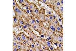 Immunohistochemical analysis of HLA-A staining in mouse liver formalin fixed paraffin embedded tissue section.