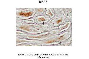Sample Type :  Mouse sciatic nerve  Primary Antibody Dilution :  1:500  Secondary Antibody :  Biotinylated Anti-Rabbit 1:1000 followed by avidin-biotin and diaminobenzidine  Secondary Antibody Dilution :  1:1000  Gene Name :  MFAP4  Submitted by :  Beth Friedman, Ph.