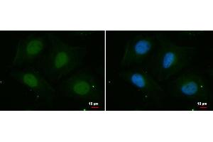 ICC/IF Image PSKH2 antibody [N2C3] detects PSKH2 protein at nucleus by immunofluorescent analysis. (PSKH2 Antikörper)