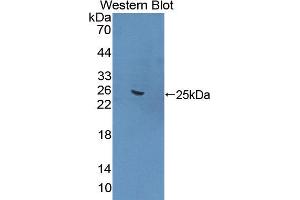 Western blot analysis of the recombinant protein. (FNBP1 Antikörper  (AA 348-529))