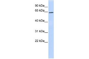 WB Suggested Anti-SUV39H1 Antibody Titration:  0. (SUV39H1 Antikörper  (N-Term))