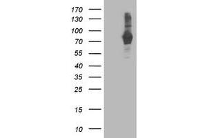 Western Blotting (WB) image for anti-phosphodiesterase 4B, cAMP-Specific (PDE4B) antibody (ABIN1500091) (PDE4B Antikörper)