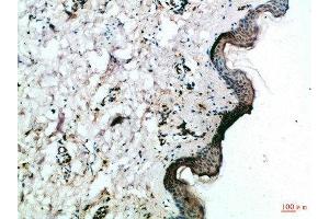 Immunohistochemical analysis of paraffin-embedded Human-skin, antibody was diluted at 1:100 (FZD4 Antikörper  (AA 11-60))