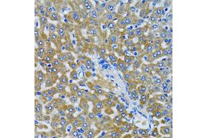 Immunohistochemistry of paraffin-embedded rat liver using HDAC5 antibody. (HDAC5 Antikörper)