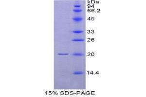 SDS-PAGE (SDS) image for Myosin Regulatory Light Chain 2, Smooth Muscle Isoform (MYL9) (AA 5-163) protein (His tag) (ABIN2121714) (MYL9 Protein (AA 5-163) (His tag))