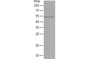 Western Blotting (WB) image for Microphthalmia-Associated Transcription Factor (MITF) (AA 1-223) protein (His-IF2DI Tag) (ABIN7123955) (MITF Protein (AA 1-223) (His-IF2DI Tag))