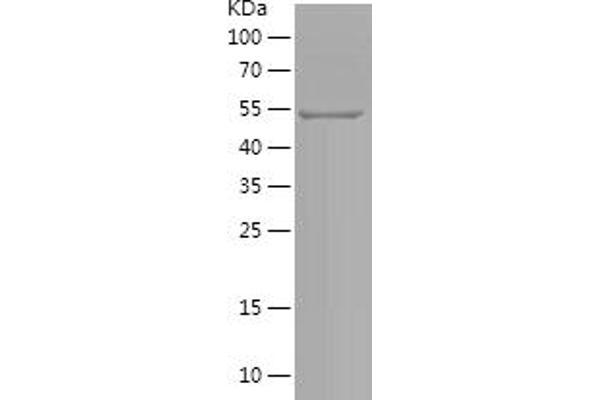 MITF Protein (AA 1-223) (His-IF2DI Tag)