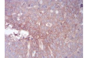 Immunohistochemistry (IHC) image for anti-Zinc Finger Protein GLI1 (GLI1) (AA 284-449) antibody (ABIN5866847) (GLI1 Antikörper  (AA 284-449))