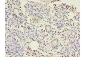 Immunohistochemistry of paraffin-embedded human pancreatic tissue using ABIN7148290 at dilution of 1:100 (TMEM27 Antikörper  (AA 15-141))