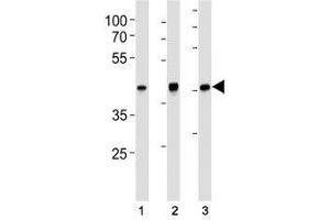 TBP antibody western blot analysis in (1) HeLa, (2) HepG2, (3) mouse NIH3T3 lysate. (TBP Antikörper)