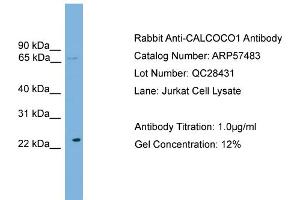 WB Suggested Anti-CALCOCO1  Antibody Titration: 0. (CALCOCO1 Antikörper  (N-Term))