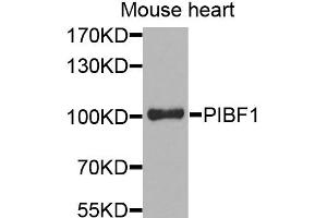 Western blot analysis of extracts of mouse heart, using PIBF1 antibody. (PIBF1 Antikörper)