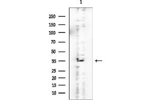 Western blot analysis of lysates from EC304 cells, using FBL Mouse Monoclonal Antibody at 1/1000 dilution.