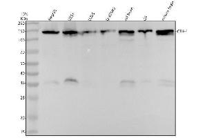 Western blot analysis of CDH4 using anti-CDH4 antibody (ABIN7606104).