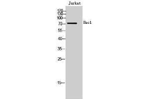 Western Blotting (WB) image for anti-NDC80 Kinetochore Complex Component Homolog (NDC80) (Internal Region) antibody (ABIN3175471) (NDC80 Antikörper  (Internal Region))