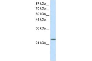 Western Blotting (WB) image for anti-MAX Dimerization Protein 3 (MXD3) antibody (ABIN2460166) (MXD3 Antikörper)