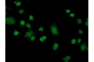 Anti-FKBPL mouse monoclonal antibody (ABIN2454034) immunofluorescent staining of COS7 cells transiently transfected by pCMV6-ENTRY FKBPL (RC202153). (FKBPL Antikörper)