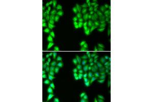 Immunofluorescence analysis of U20S cell using MALT1 antibody. (MALT1 Antikörper)