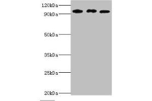 Western blot All lanes: SOX6 antibody at 10 μg/mL Lane 1: Jurkat whole cell lysate Lane 2: Hela whole cell lysate Lane 3: 293T whole cell lysate Secondary Goat polyclonal to rabbit IgG at 1/10000 dilution Predicted band size: 92, 90, 89 kDa Observed band size: 92 kDa (SOX6 Antikörper  (AA 1-74))
