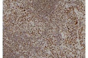 ABIN6259986 and ABIN6278790 at 1/100 staining Mouse spleen tissue by IHC-P. (APOBEC3C Antikörper  (C-Term))