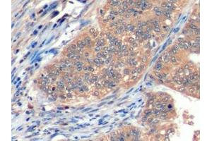 Immunohistochemistry (IHC) image for anti-Inducible T-Cell Co-Stimulator Ligand (ICOSLG) (AA 23-249) antibody (ABIN7439975)