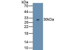 Detection of Recombinant TJP3, Rat using Polyclonal Antibody to Tight Junction Protein 3 (TJP3) (TJP3 Antikörper  (AA 1-243))