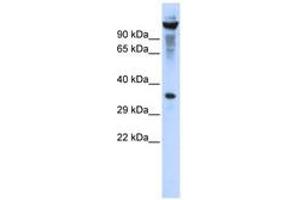 Image no. 1 for anti-Ribonuclease T2 (RNASET2) (AA 107-156) antibody (ABIN6740327) (RNASET2 Antikörper  (AA 107-156))