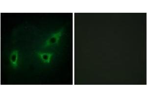 Immunofluorescence analysis of HeLa cells, using ATP7B Antibody. (ATP7B Antikörper  (AA 161-210))