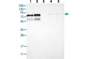 Western blot analysis of Lane 1: RT-4, Lane 2: U-251 MG, Lane 3: Human Plasma, Lane 4: Liver, Lane 5: Tonsil with MTA2 polyclonal antibody  at 1:250-1:500 dilution.