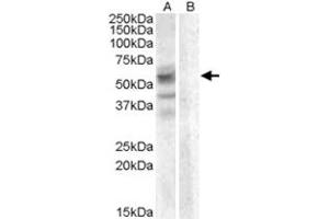 ARSD polyclonal antibody  (0.