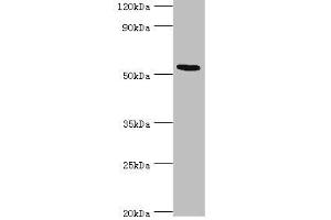 Western blot All lanes: ATF7 antibody at 12 μg/mL + Hela whole cell lysate Secondary Goat polyclonal to rabbit IgG at 1/10000 dilution Predicted band size: 53, 50, 51, 34, 14, 52 kDa Observed band size: 53 kDa (AFT7 Antikörper  (AA 1-117))
