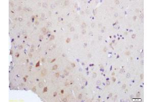 Formalin-fixed and paraffin embedded rat brain tissue labeled with Rabbit Anti-Vitamin D3 Receptor Polyclonal Antibody, Unconjugated (ABIN2559664) at 1:200 followed by conjugation to the secondary antibody and DAB staining (Vitamin D Receptor Antikörper  (AA 51-150))