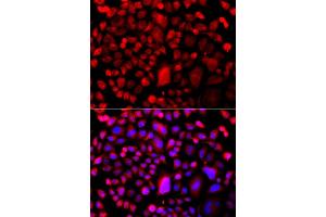 Immunofluorescence analysis of A549 cell using TP53BP2 antibody. (TP53BP2 Antikörper)