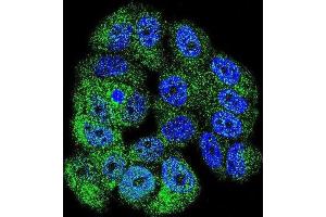 Immunofluorescence (IF) image for anti-C-Abl Oncogene 1, Non-Receptor tyrosine Kinase (ABL1) antibody (ABIN3003438) (ABL1 Antikörper)